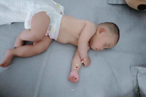 沭阳宝宝脸上有白色斑块